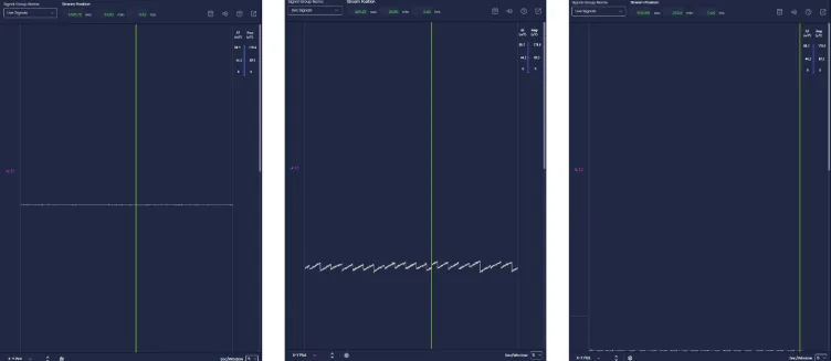 The same raw trace at low, correct and high Vref_FFx — flat and saturated on the left and right, a clean sawtooth in the middle
